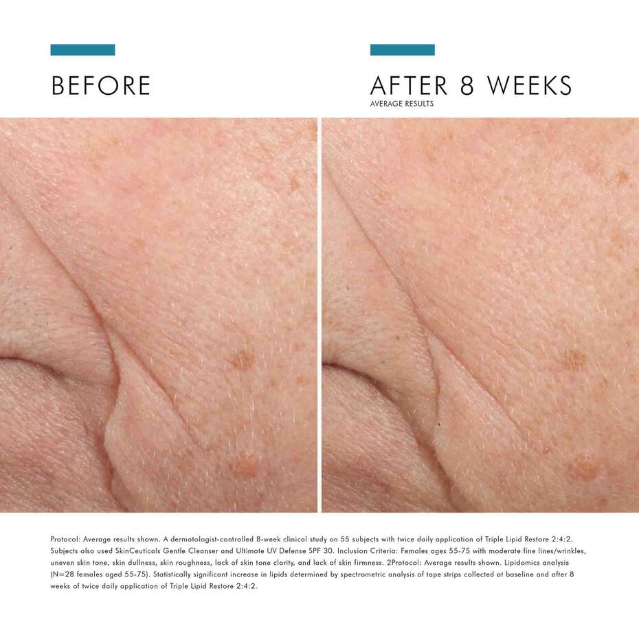 SkinCeuticals Triple Lipid Restore 2:4:2 (1.6 fl. oz.)