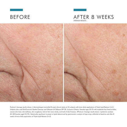 SkinCeuticals Triple Lipid Restore 2:4:2 (1.6 fl. oz.)